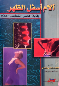 Image of الام اسفل الظهر