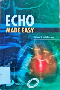 Image of Echo Made Easy