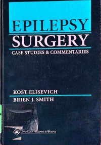 Image of Epilepsy Surgery