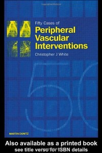 Image of Fifty Cases of Peripheral Vascular Interventions