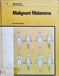 Image of Malignant Melanoma