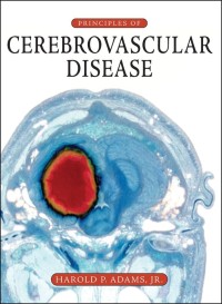 Image of Principles of Cerebrovascular Disease